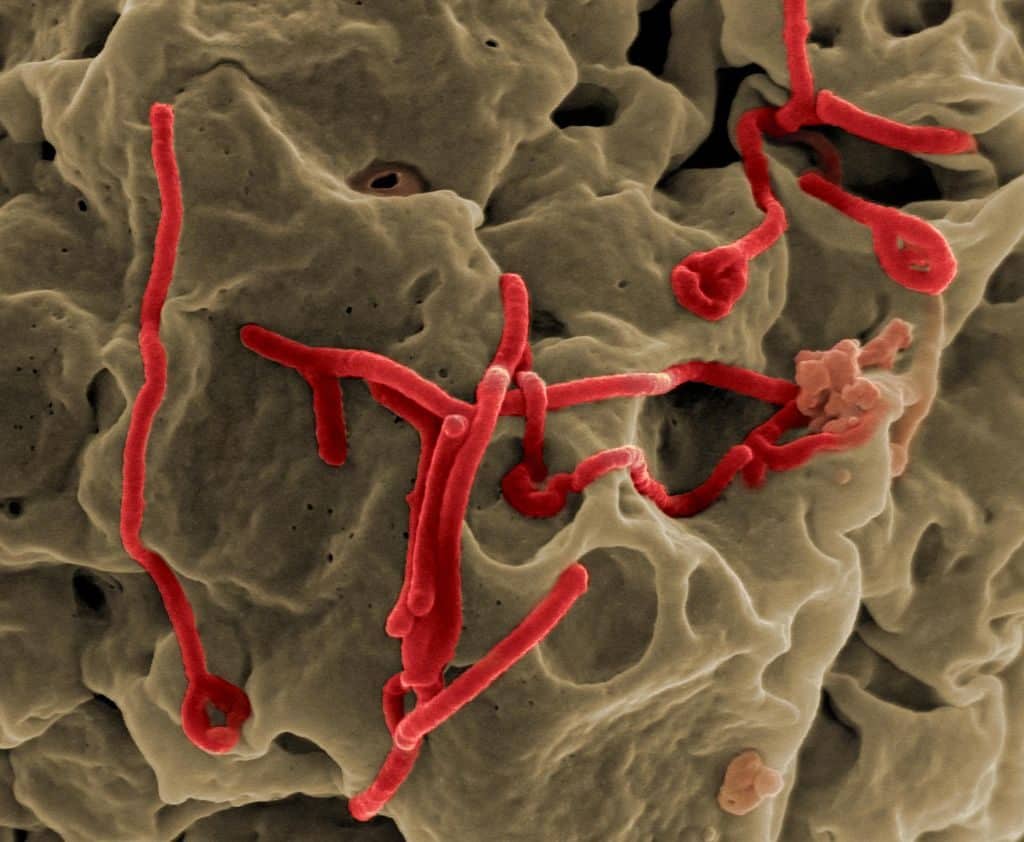 Il virus ebola che sta causando l'emergenza in Congo.