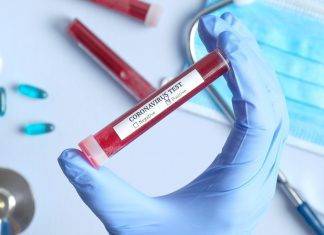 Coronavirus, arriva l’esito del test sul caso sospetto a Napoli coronavirus
