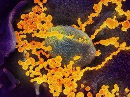 Coronavirus a Napoli, risulta positivo il tampone dell’uomo tornato da Milano