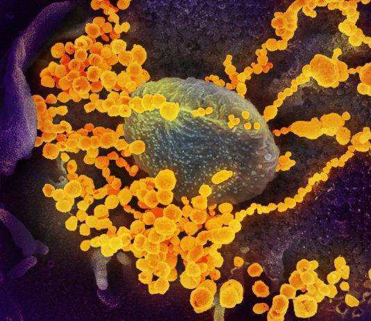 Coronavirus a Napoli, risulta positivo il tampone dell’uomo tornato da Milano