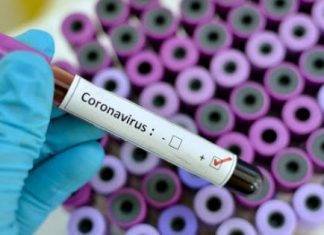 Coronavirus: vaccino australiano supera test di laboratorio