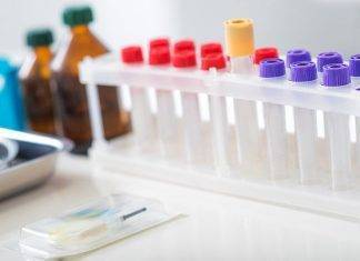 Coronavirus: arriva il nuovo test che ti da il risultato in 15 minuti