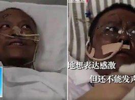 Cina, mutano il colore della pelle a causa del Covid-19