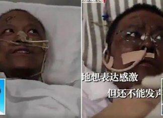 Cina, mutano il colore della pelle a causa del Covid-19