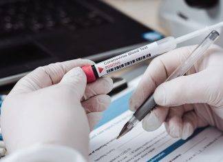Coronavirus, ecco chi potrà fare i test sierologici Coronavirus, test sierologici