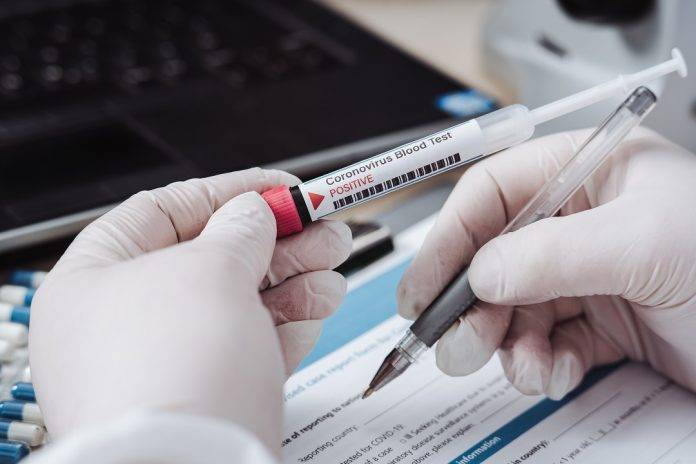 Coronavirus, test sierologici