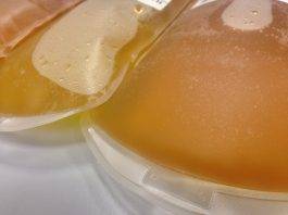 Coronavirus, la nuova terapia al plasma ed i suoi risultati positivi