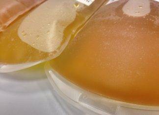 Coronavirus, la nuova terapia al plasma ed i suoi risultati positivi
