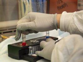 Roma: sono 12 i nuovi casi di Coronavirus