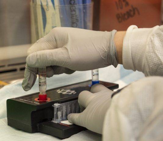 Roma: sono 12 i nuovi casi di Coronavirus