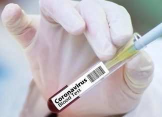 Coronavirus, un italiano su due pensa di non vaccinarsi: “Urgente campagna anti fake news”