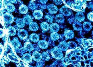 Coronavirus: nuovo record di contagi a livello mondiale Il Coroavirus al microscopio (Scienza in rete)