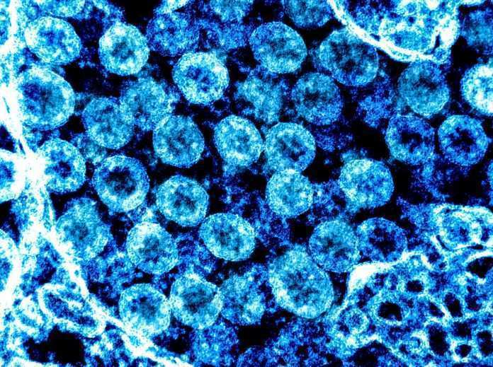 Il Coroavirus al microscopio (Scienza in rete)