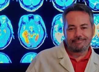 Si risveglia dopo un ictus con l’accento slavo: è il primo caso in Italia