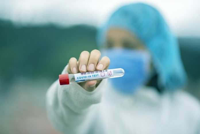 test-tube-5065425_960_720