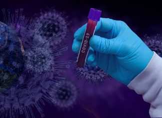 Coronavirus, a Padova positive 30 persone dell’asilo notturno