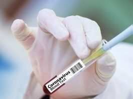 AstraZeneca riprende i test sul vaccino anti Coronavirus: “Non ci sono rischi”