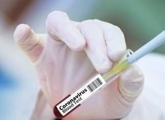 AstraZeneca riprende i test sul vaccino anti Coronavirus: “Non ci sono rischi”