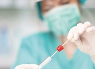 Covid, tamponi rapidi in farmacia: parte la sperimentazione tamponi rapidi