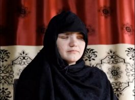 Afghanistan: accecata perché lavoratrice