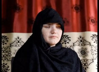 Afghanistan: accecata perché lavoratrice
