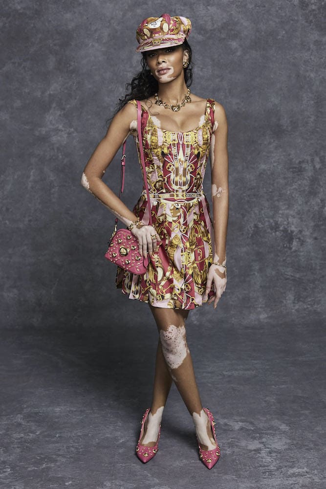 Winnie Harlow-photo credits: 10magazine.com