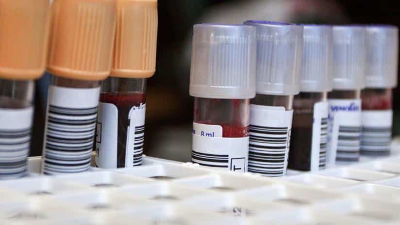 Immagine di provette di gruppi sanguigni  photo credit:paginemediche.it