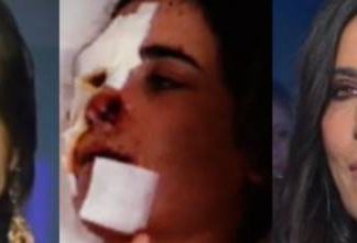 Paola Turci e quel brutto incidente: “Sono riuscita a rinascere”