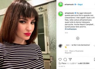 Tricotillomania, la malattia di cui soffre Arisa
