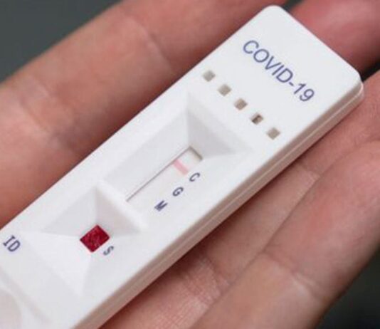 Covid, via libera del ministero della Salute per i test salivari Test salivari, fonte gildavenezia.it