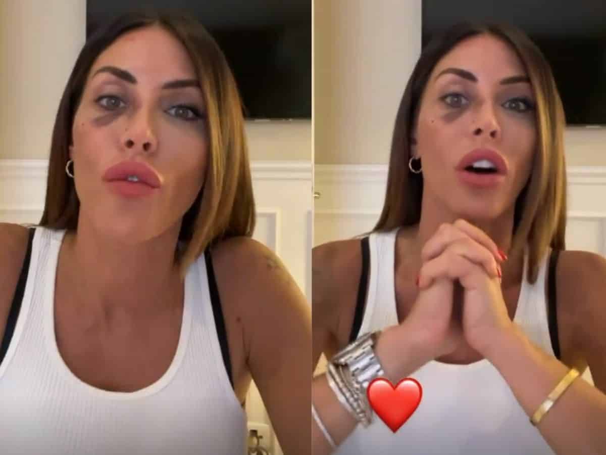 Guendalina Tavassi rompe il silenzio e dice la verità sulla sua aggressione