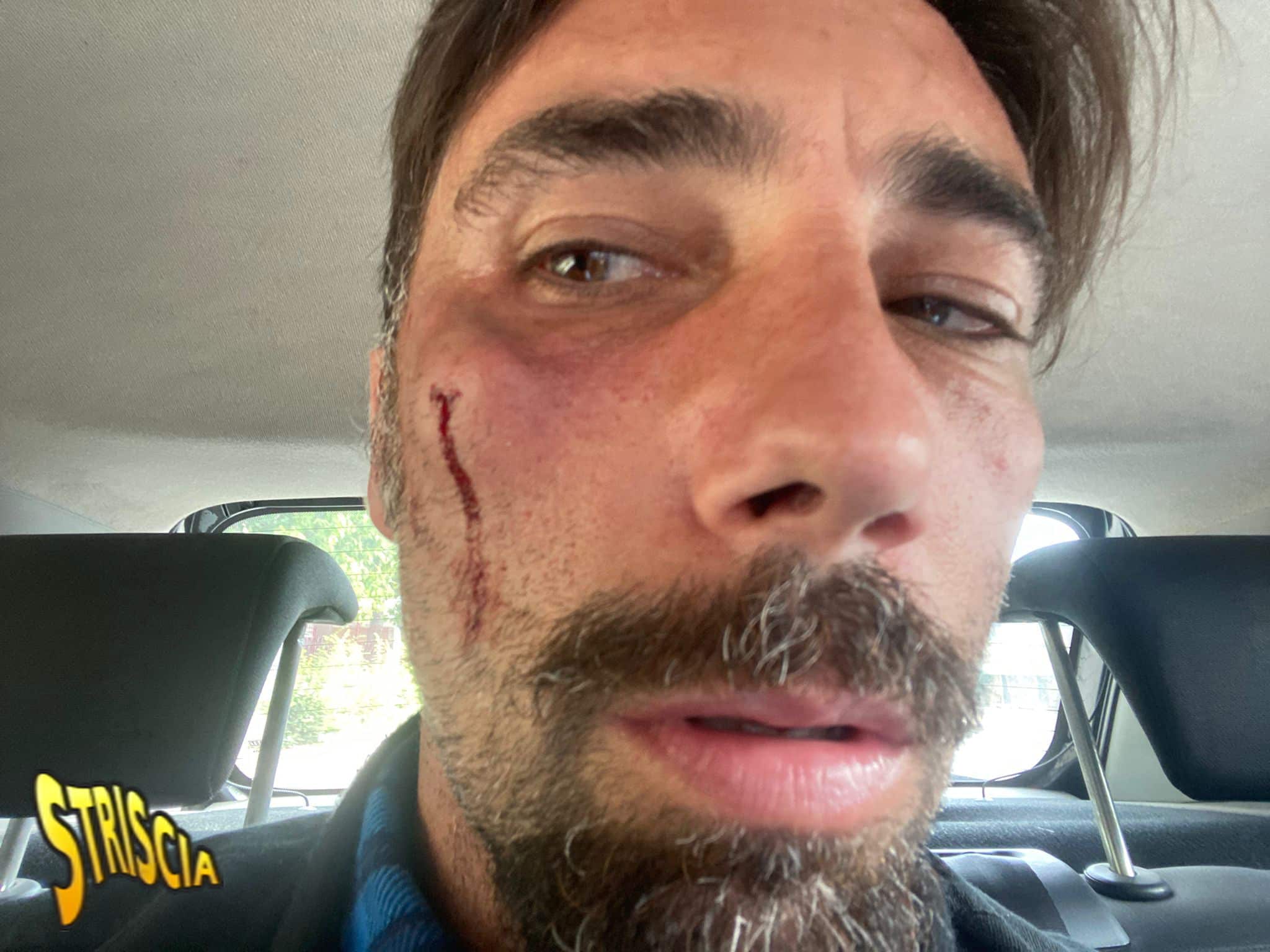 Striscia la Notizia, questa sera il video completo dell’aggressione shock a Brumotti Brumotti_S_Severo - Credits: Ufficio Stampa Striscia la Notizia