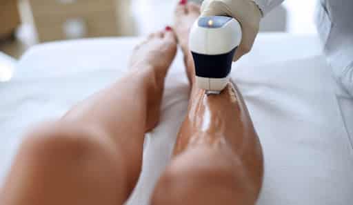 Epilazione laser, perché sceglierla