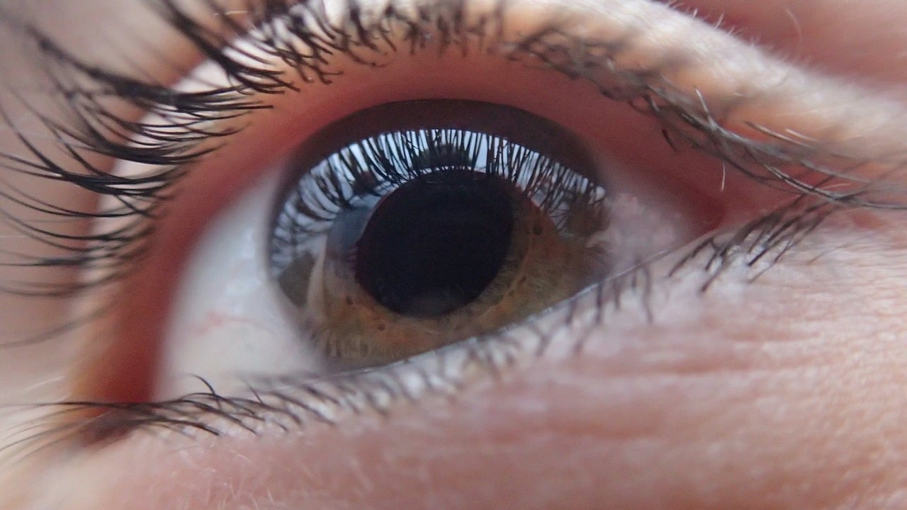 Il cheratocono: una malattia degenerativa della cornea che può colpire anche i più giovani cheratocono