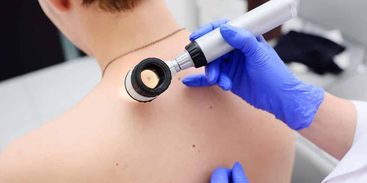 Perché trovare un dermatologo è importante