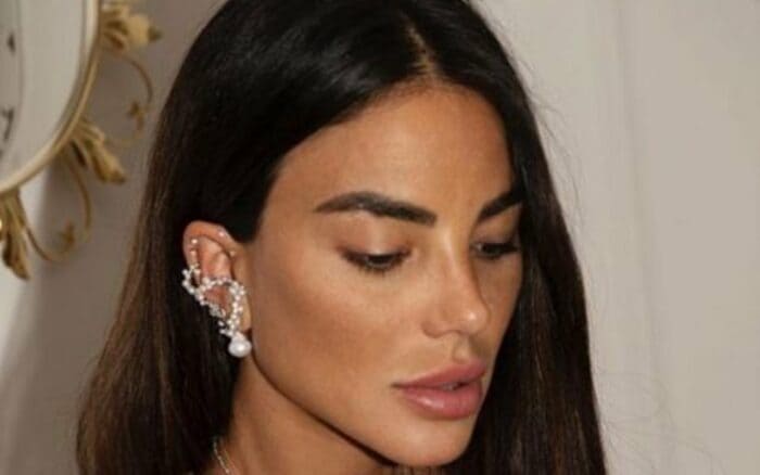 Chiara Biasi pentita del filler al viso, decide di dissolverlo Chiara Biasi filler – Photo Credits bloglive.it