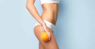 Cellulite, quale trattamento scegliere cellulite