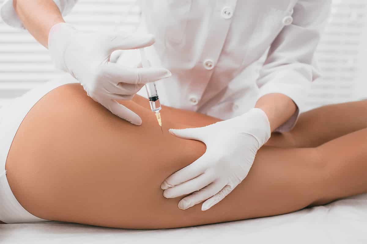 Mesoterapia per la cellulite, come funziona