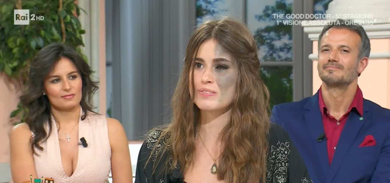 Chi è Carlotta Bertotti: “Mi vergognavo del mio viso, ora poso per Vogue”