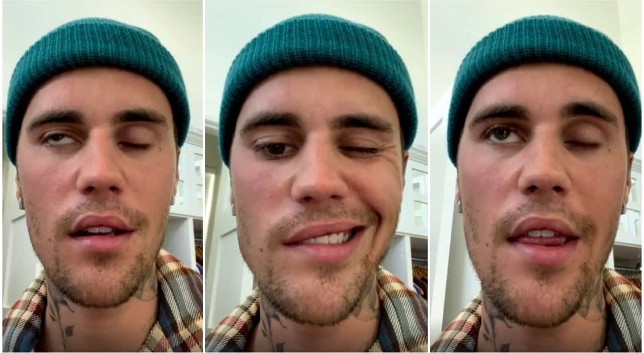 Justin Bieber rivela la sua malattia Ramsay Hunt: “Ho una paralisi del volto, non posso cantare”
