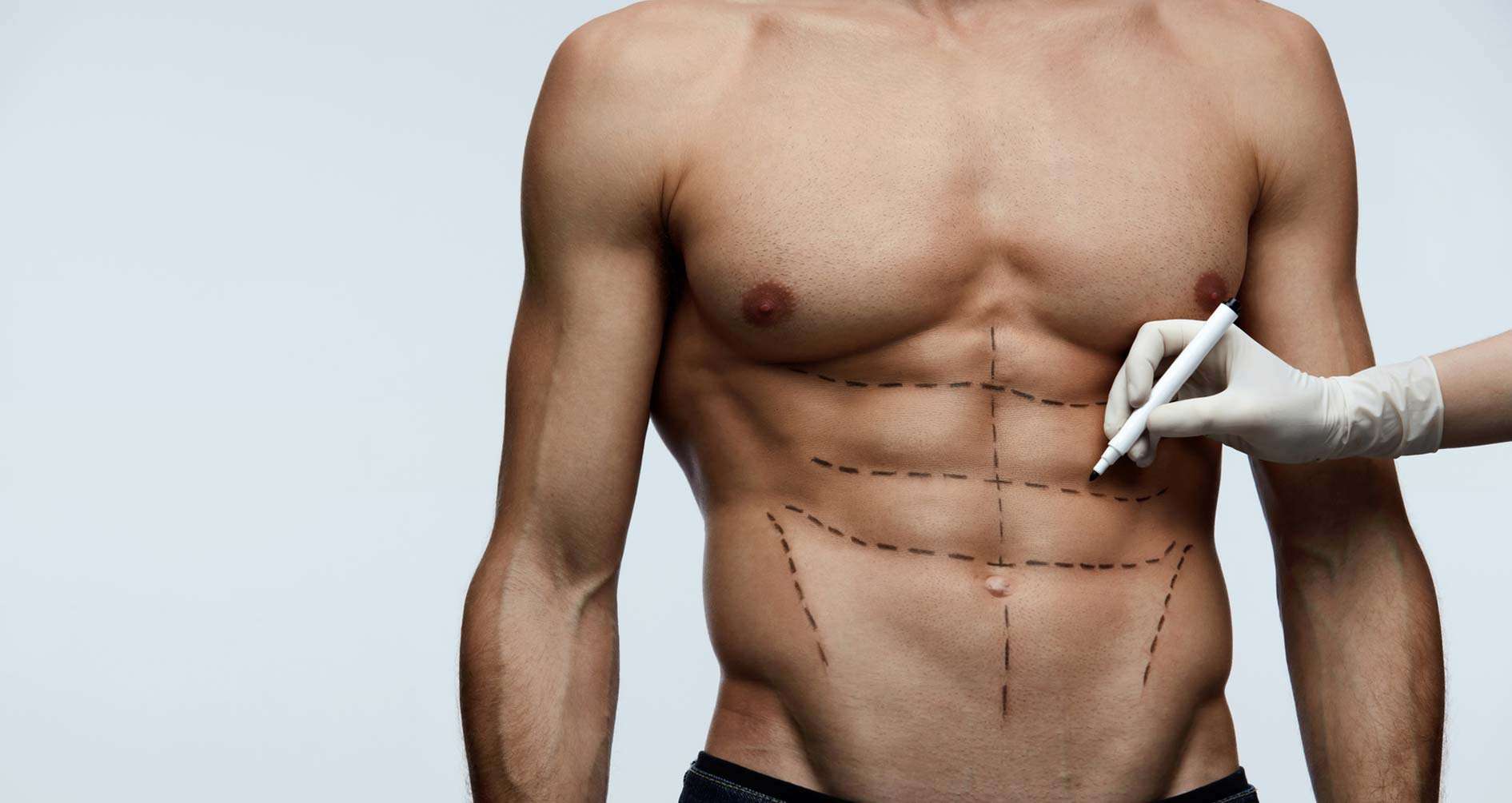 Liposcultura addome: cosa bisogna sapere