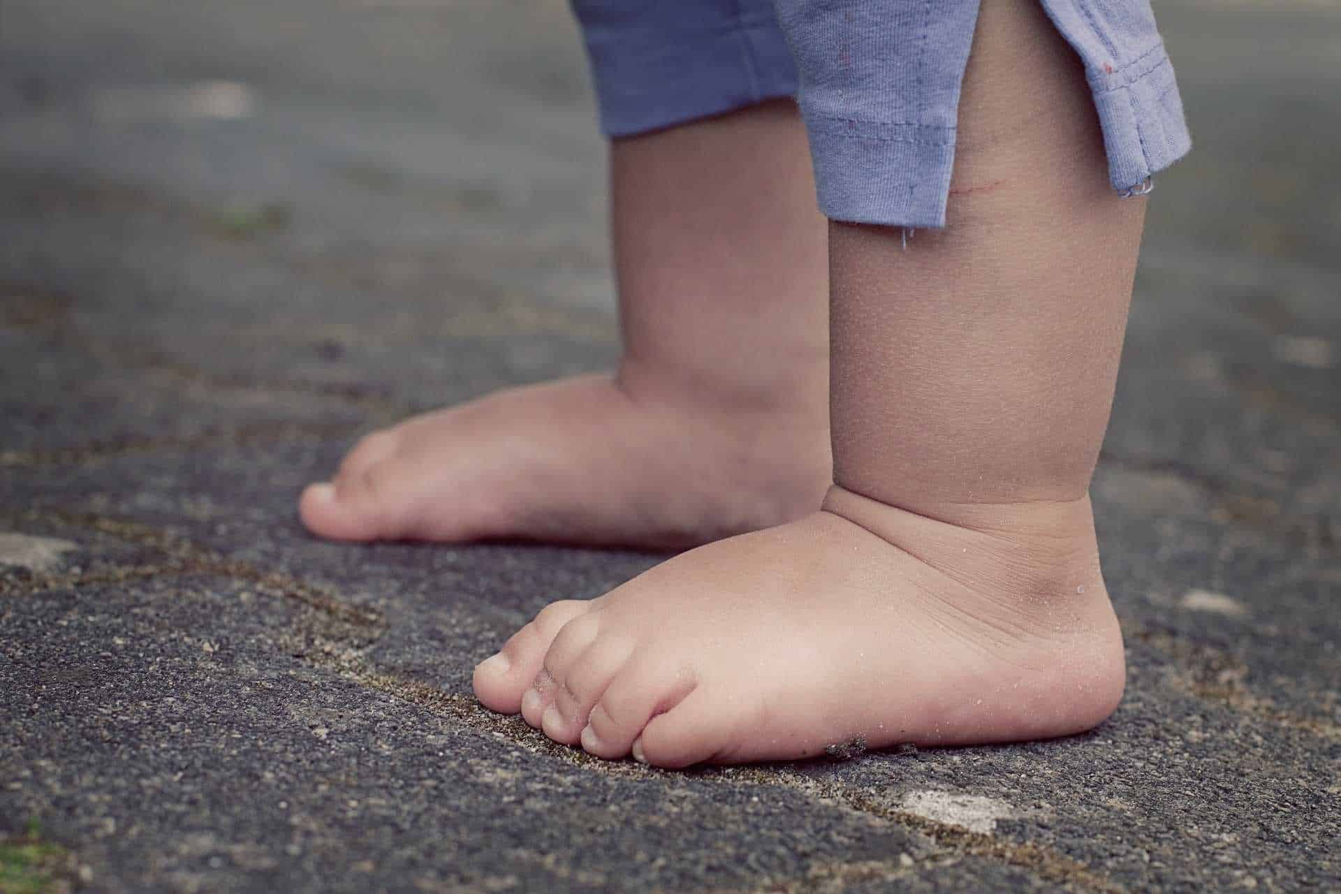 I migliori rimedi naturali contro le gambe gonfie