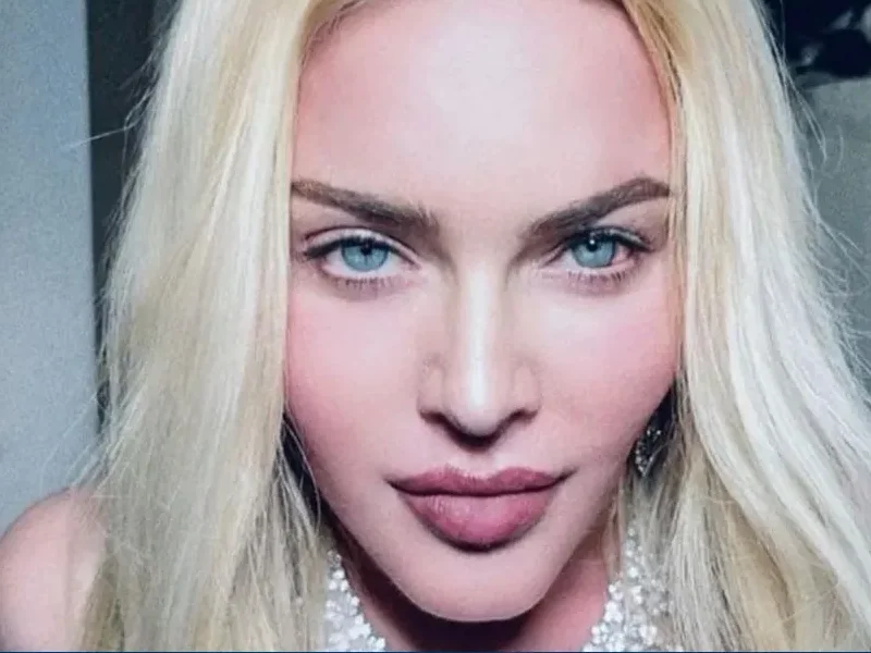 Madonna su Instagram dopo il ricovero: “Non volevo deludere i miei fan” Madonna © nuovo mille
