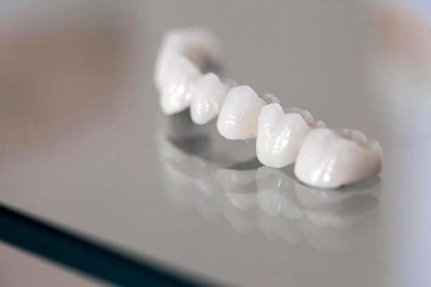 Corone in Zirconia ed E-Max in Turchia: Valorizza il Tuo Sorriso