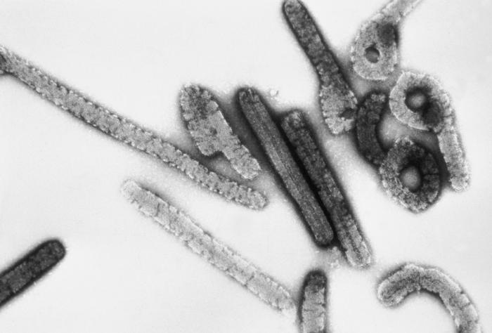 virus marburg 