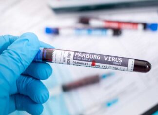 Virus Marburg, in Germania è allarme: possibile caso di contagio presso la stazione di Amburgo