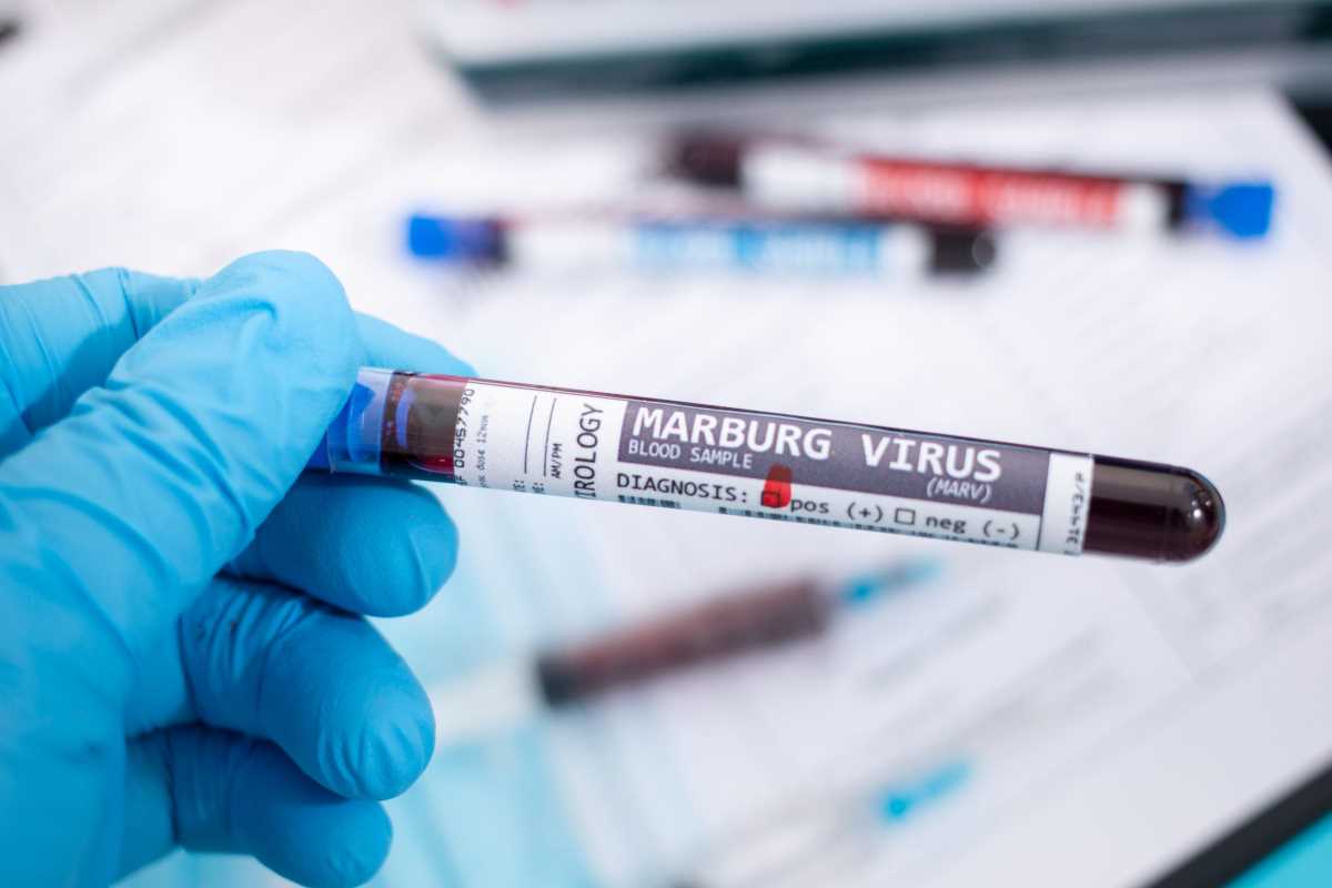 Virus Marburg, in Germania è allarme: possibile caso di contagio presso la stazione di Amburgo