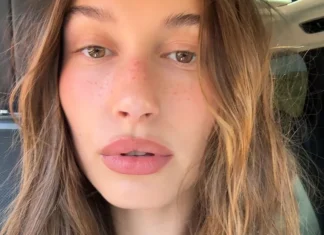 E se vi dicessimo che le vere protagoniste dell’estate sono le fake freckles?