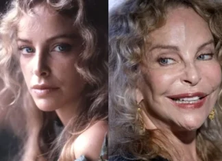Cosa è successo al viso di Sydne Rome? La sua bellezza degli anni ’80 persa in un incidente