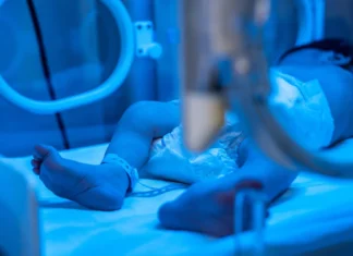 Al Bambino Gesù di Roma è stato asportato un tumore di 800 grammi ad una neonata